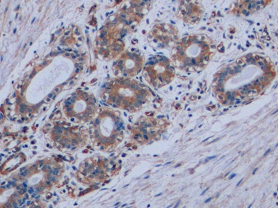 Monoclonal Antibody to Vimentin (VIM)