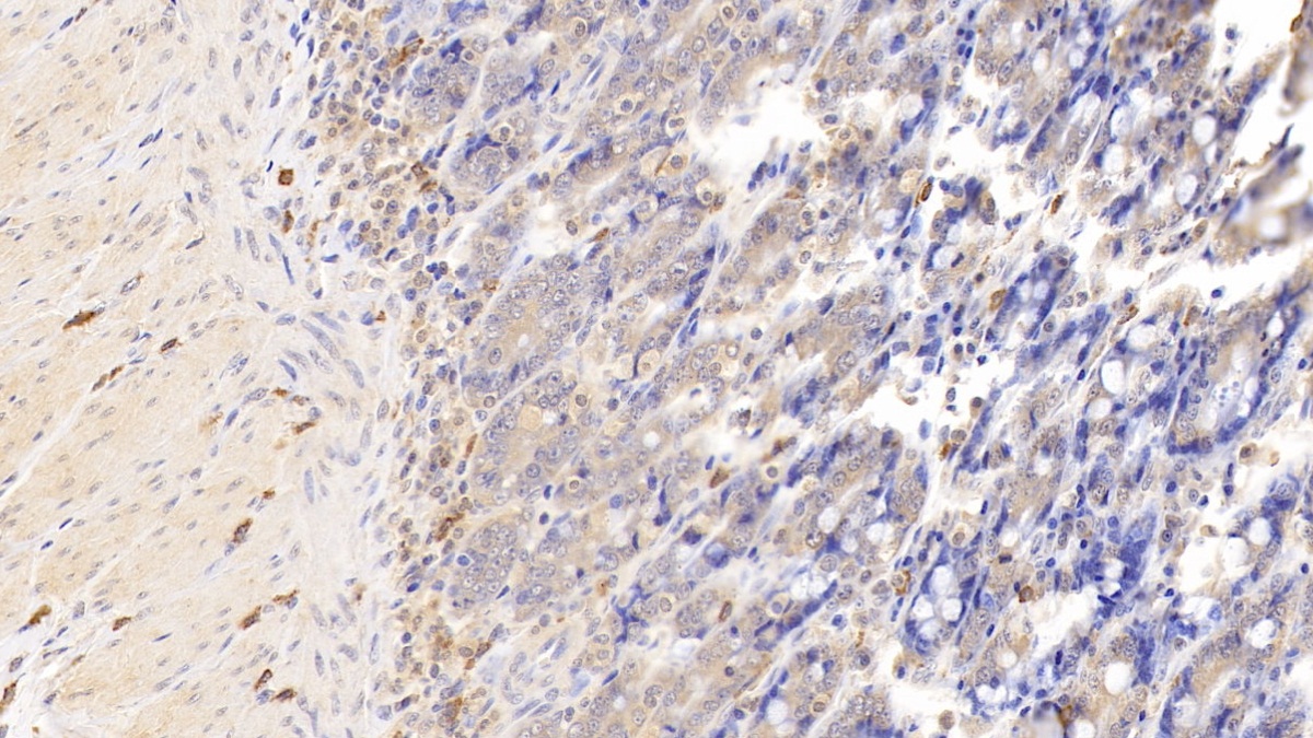 Monoclonal Antibody to Tryptase (TPS)