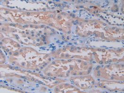 Monoclonal Antibody to Tryptase (TPS)