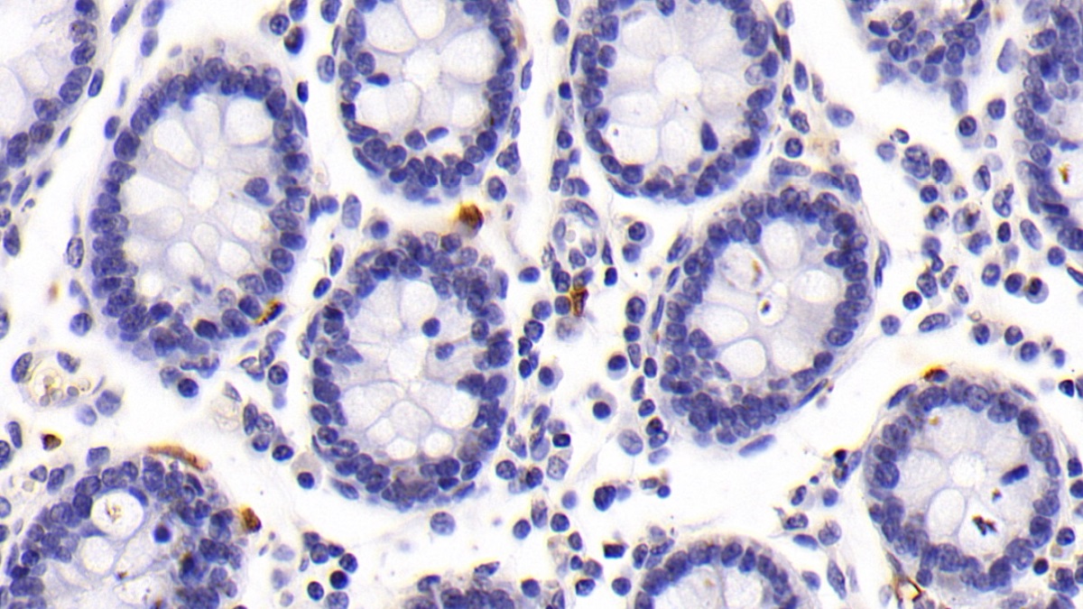 Monoclonal Antibody to Tryptase (TPS)