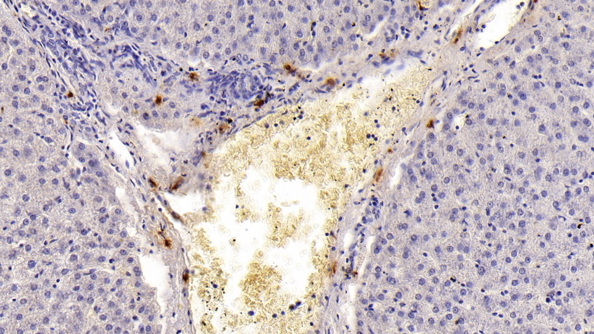 Monoclonal Antibody to Tryptase (TPS)