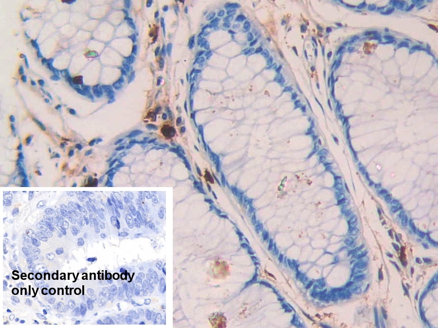 Monoclonal Antibody to Tryptase (TPS)