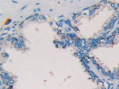 Monoclonal Antibody to Tryptase (TPS)