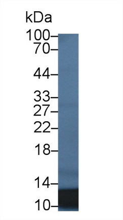 Monoclonal Antibody to S100 Calcium Binding Protein A12 (S100A12)