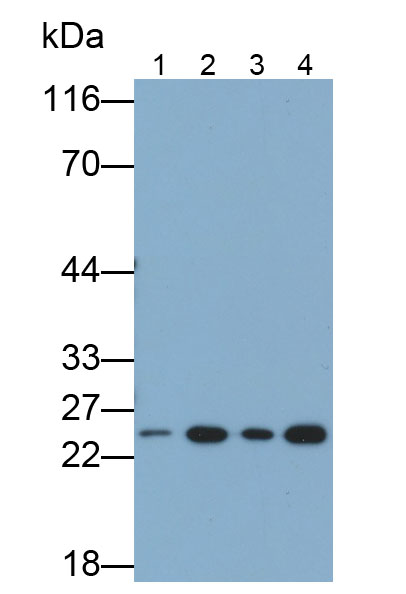 Monoclonal Antibody to Glutathione S Transferase Pi (GSTp)