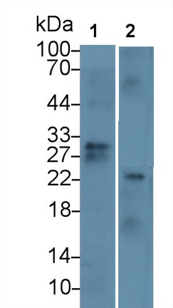 Monoclonal Antibody to Cluster Of Differentiation 8a (CD8a)