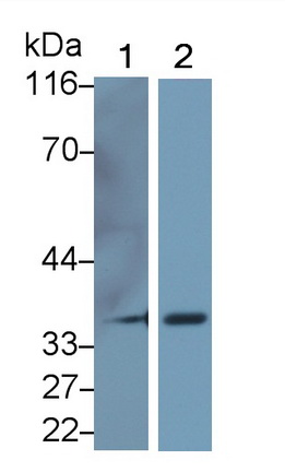 Monoclonal Antibody to Arginase (ARG)