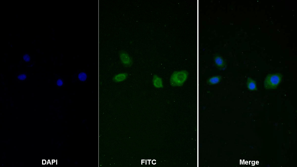 Monoclonal Antibody to Arginase (ARG)