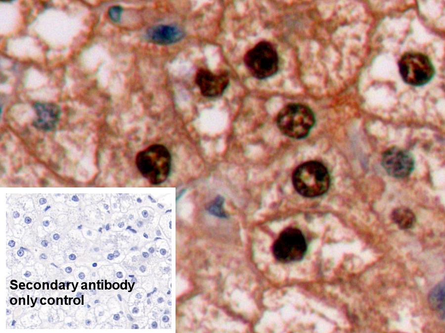 Monoclonal Antibody to Arginase (ARG)