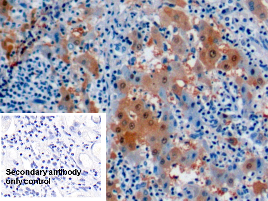 Monoclonal Antibody to Arginase (ARG)