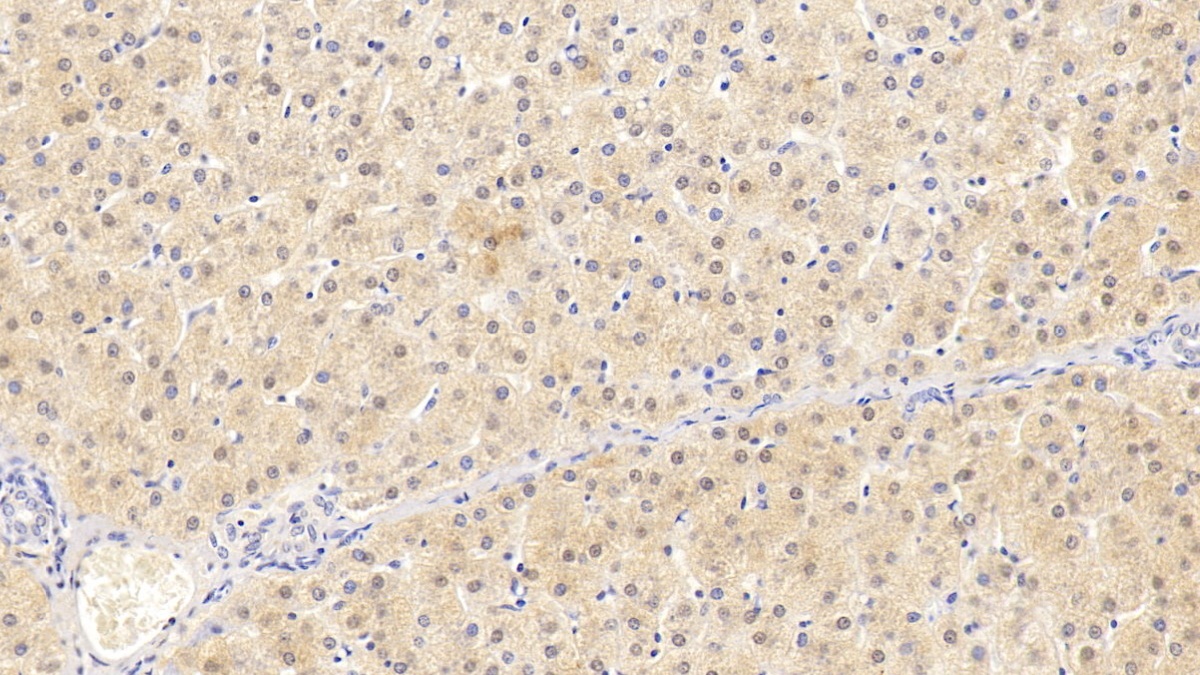 Monoclonal Antibody to Arginase (ARG)