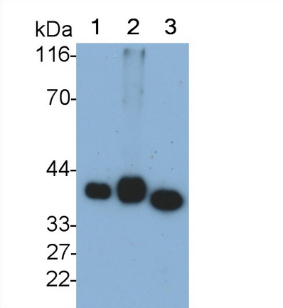 Monoclonal Antibody to Arginase (ARG)