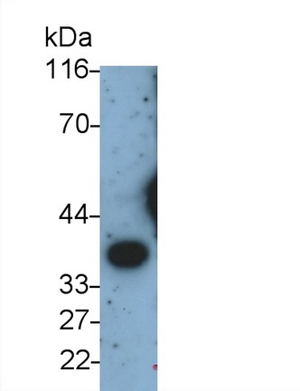 Monoclonal Antibody to Arginase (ARG)