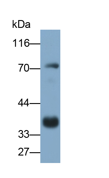 Monoclonal Antibody to Deoxyribonuclease I (DNASE1)