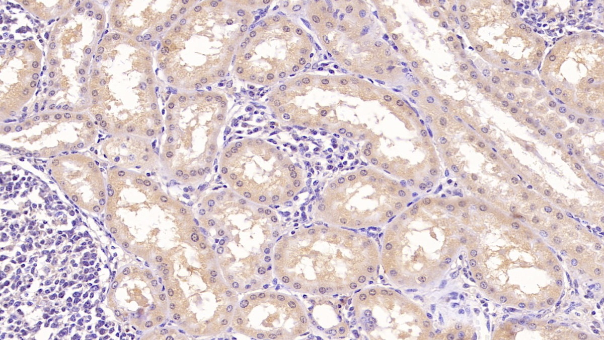 Monoclonal Antibody to Transferrin Receptor (TFR)