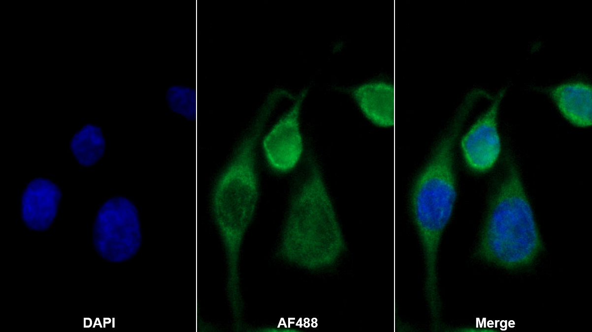 Monoclonal Antibody to Clusterin (CLU)