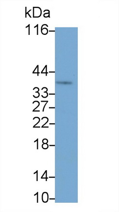 Monoclonal Antibody to Clusterin (CLU)