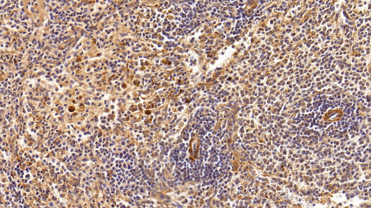 Monoclonal Antibody to Clusterin (CLU)