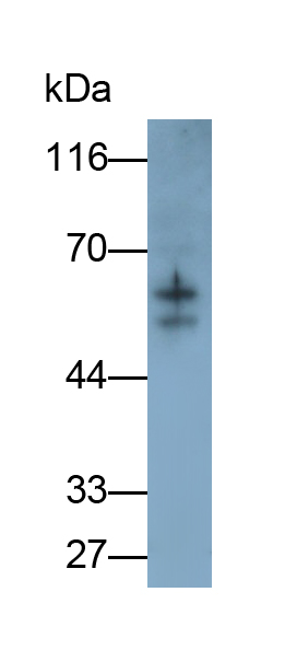 Monoclonal Antibody to Glucose Transporter 1 (GLUT1)
