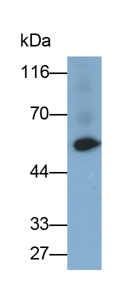 Monoclonal Antibody to Glucose Transporter 1 (GLUT1)
