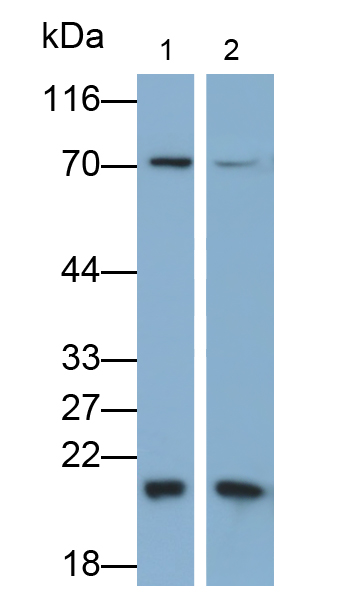 Monoclonal Antibody to Granzyme K (GZMK)