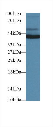 Monoclonal Antibody to Aspartate Aminotransferase (AST)