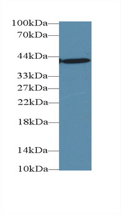 Monoclonal Antibody to Aspartate Aminotransferase (AST)