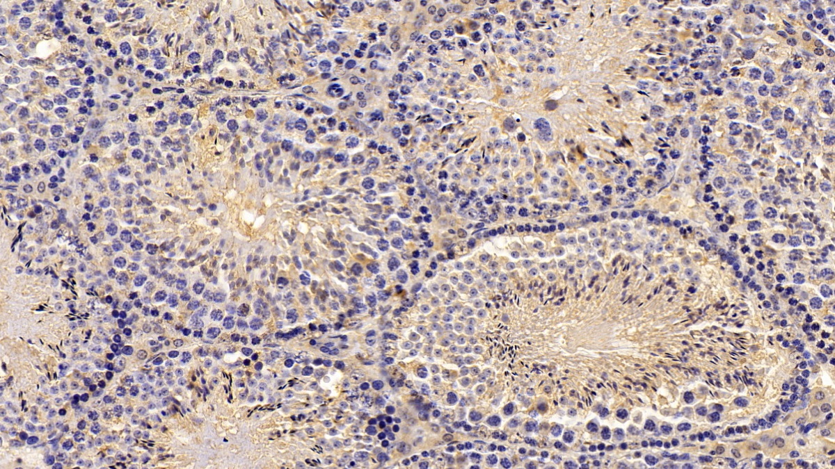 Monoclonal Antibody to Aspartate Aminotransferase (AST)