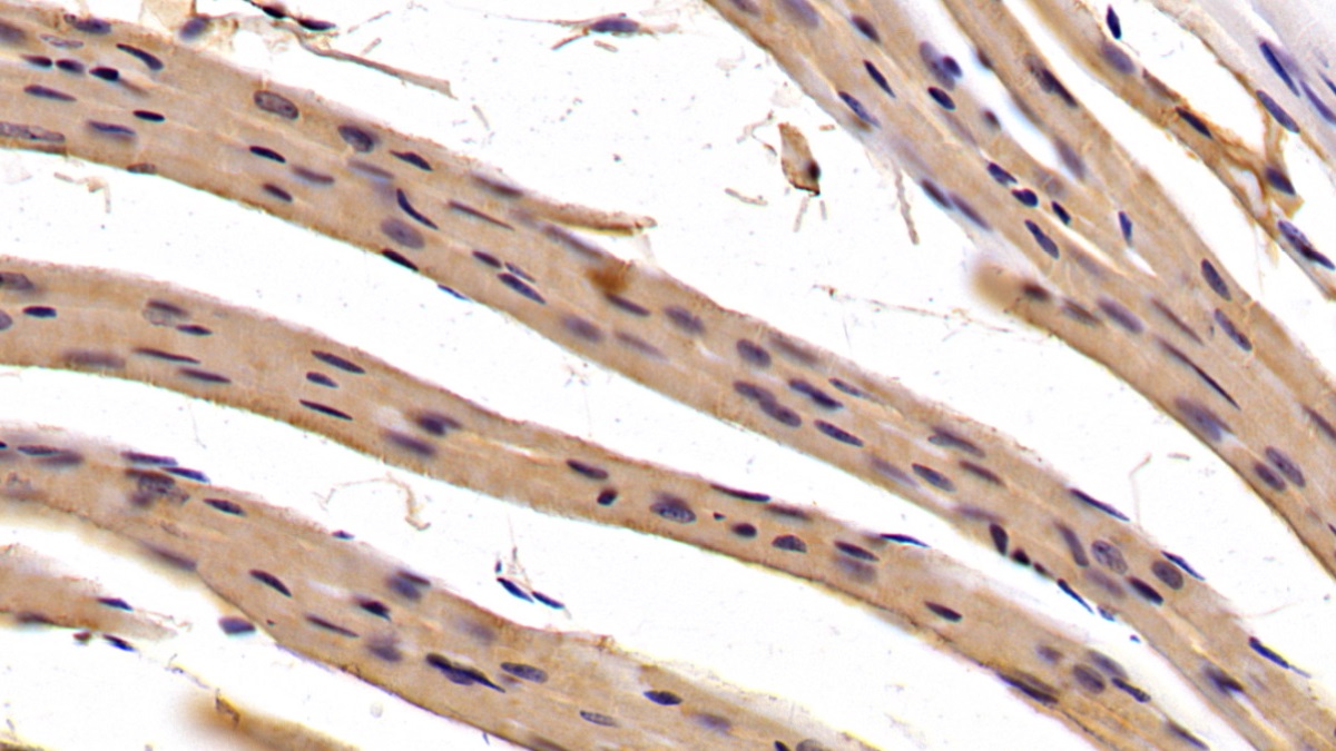 Monoclonal Antibody to Aspartate Aminotransferase (AST)