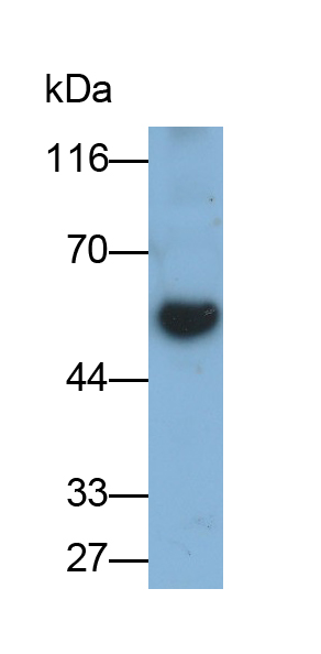 Monoclonal Antibody to Fibrinogen Beta Chain (FGB)
