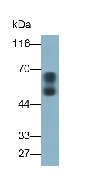 Monoclonal Antibody to Corticosteroid Binding Globulin (CBG)