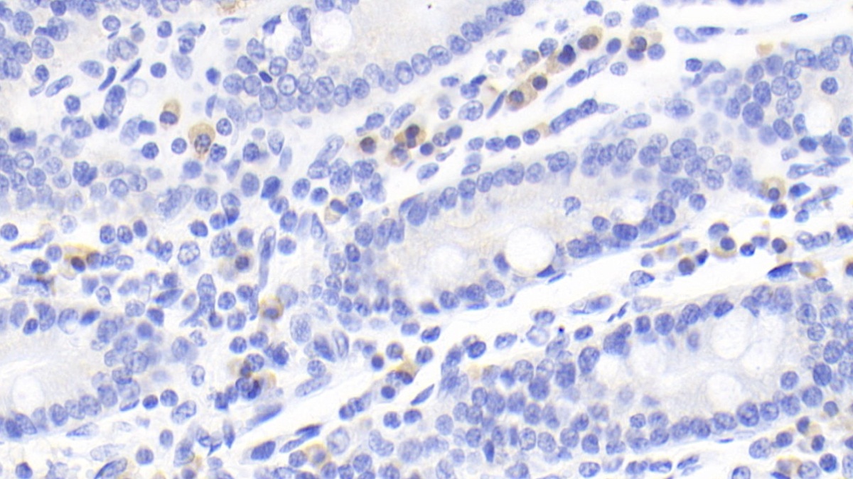 Monoclonal Antibody to Cytotoxic T-Lymphocyte Associated Antigen 4 (CTLA4)