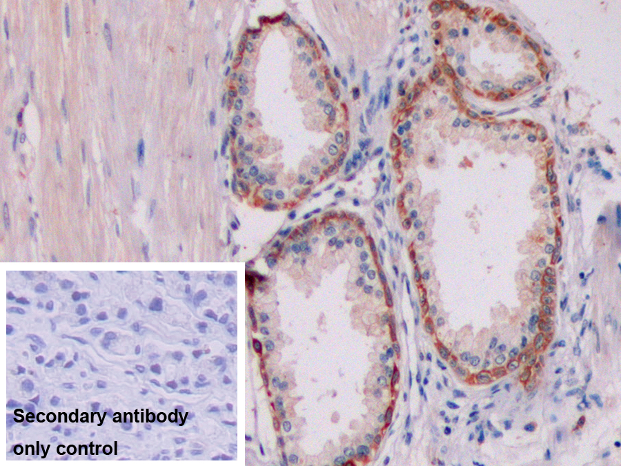 Monoclonal Antibody to Cytokeratin 19 (CK19)