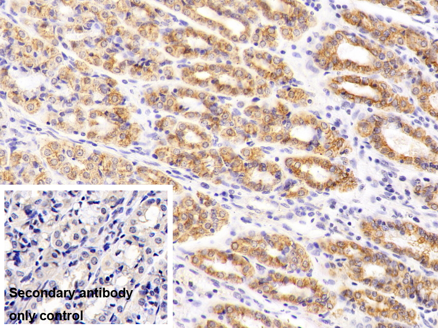 Monoclonal Antibody to Cytokeratin 19 (CK19)