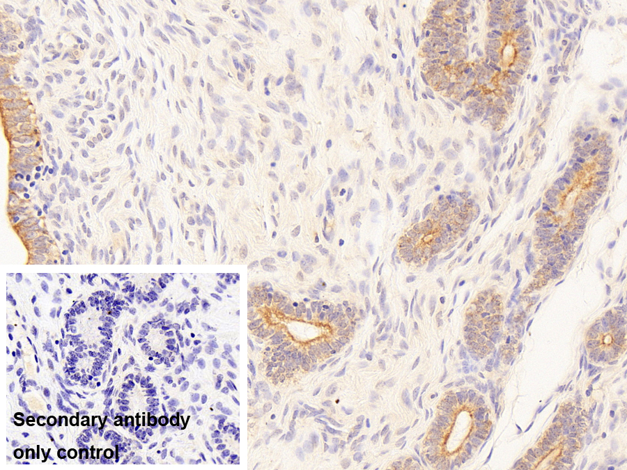 Monoclonal Antibody to Cytokeratin 19 (CK19)