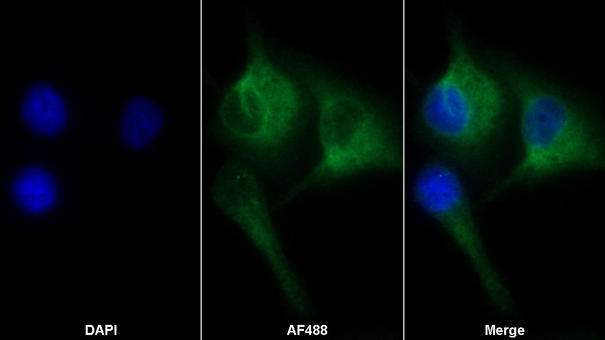 Monoclonal Antibody to Cluster Of Differentiation 73 (CD73)