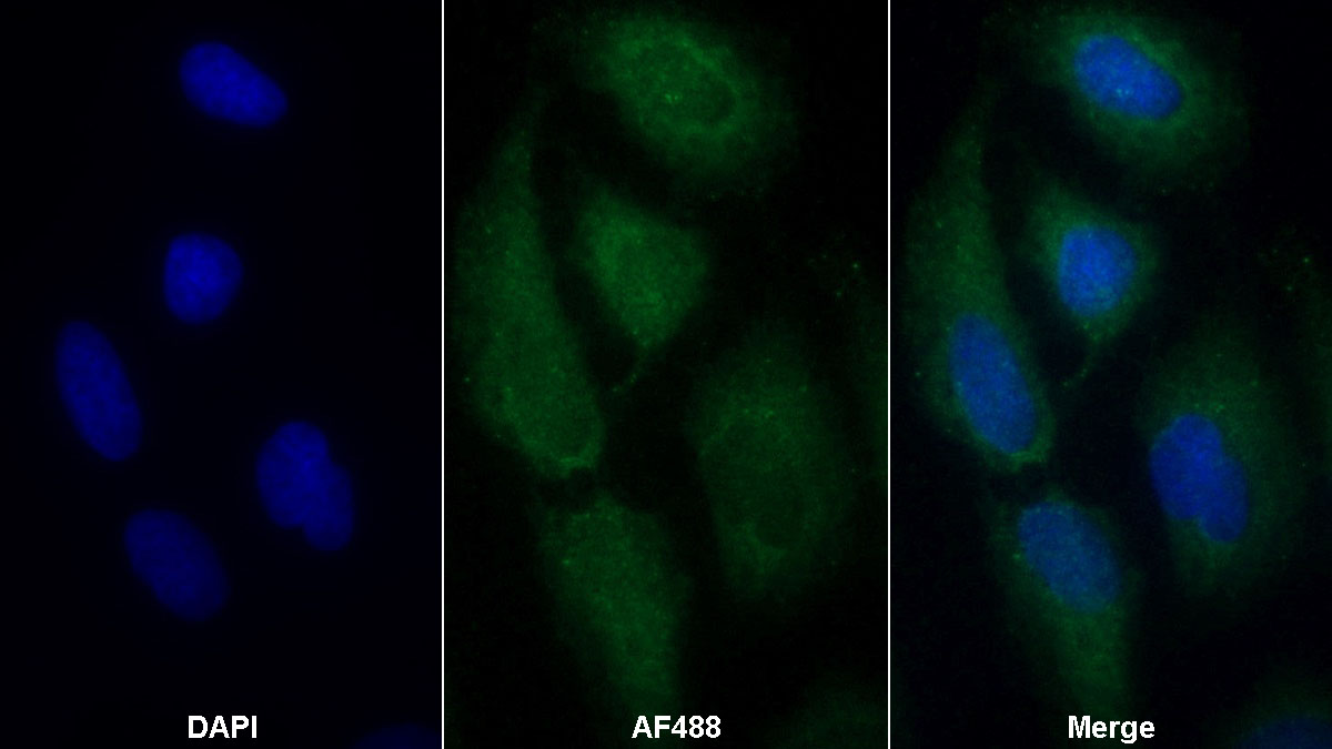 Monoclonal Antibody to Tumor Necrosis Factor Ligand Superfamily, Member 7 (TNFSF7)