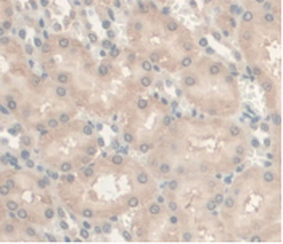 Monoclonal Antibody to Androgen Receptor (AR)