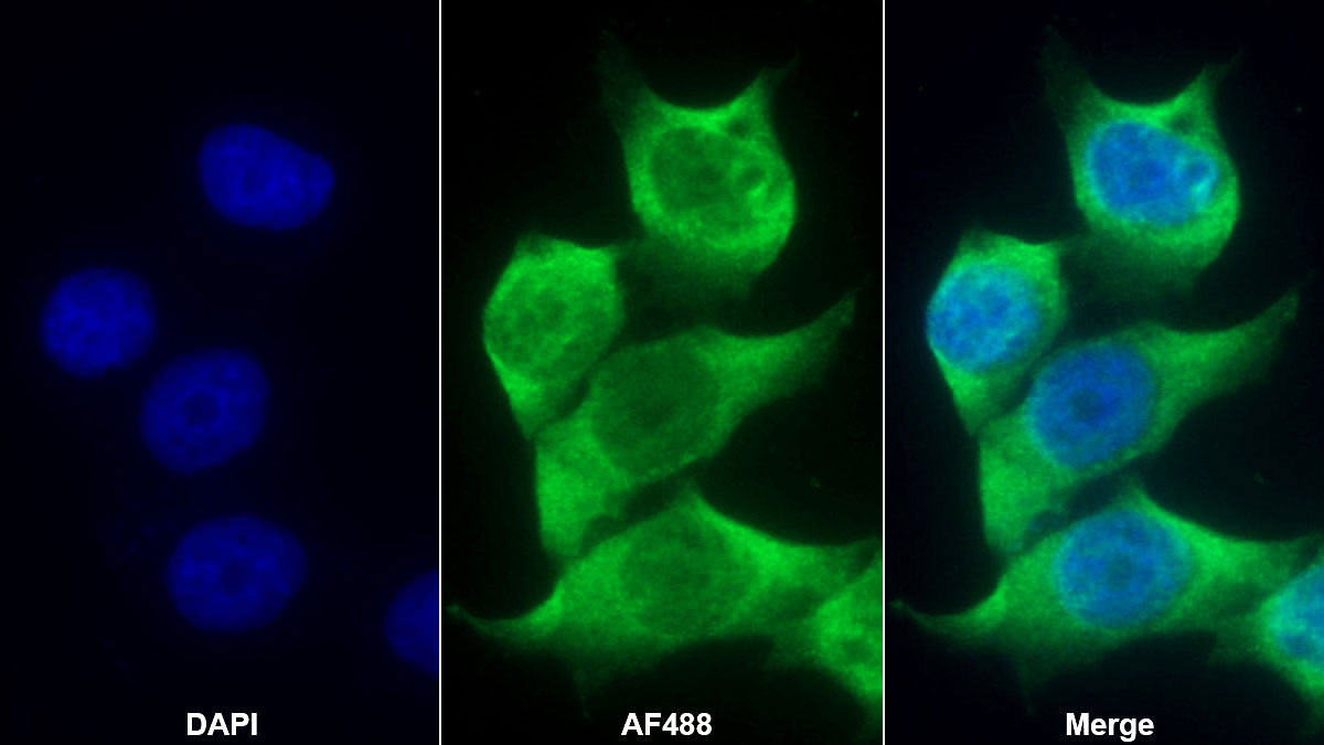 Monoclonal Antibody to Androgen Receptor (AR)