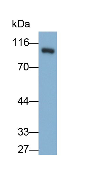 Monoclonal Antibody to Progesterone Receptor (PGR)