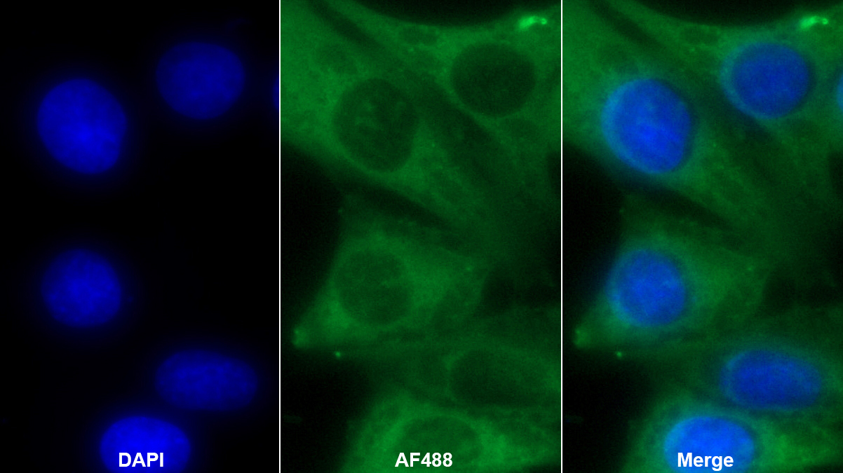 Monoclonal Antibody to Caldesmon (CALD)