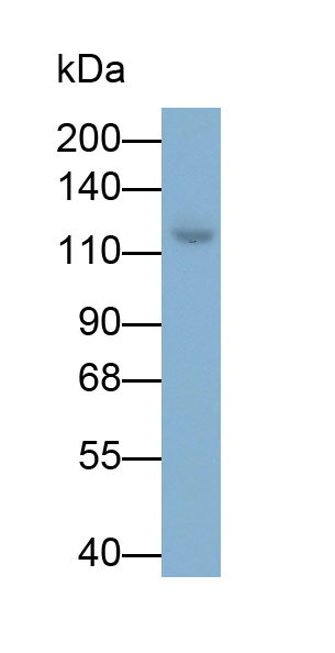 Monoclonal Antibody to Involucrin (INV)