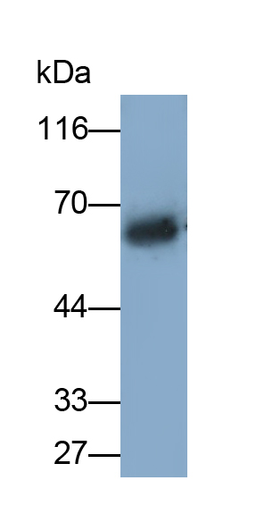 Monoclonal Antibody to Involucrin (INV)