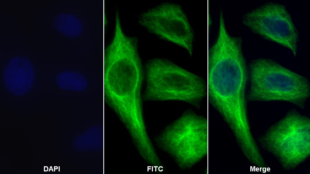 Monoclonal Antibody to Beta Actin (ACTB)