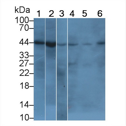 Monoclonal Antibody to Beta Actin (ACTB)