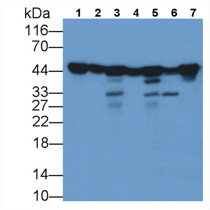 Monoclonal Antibody to Beta Actin (ACTB)