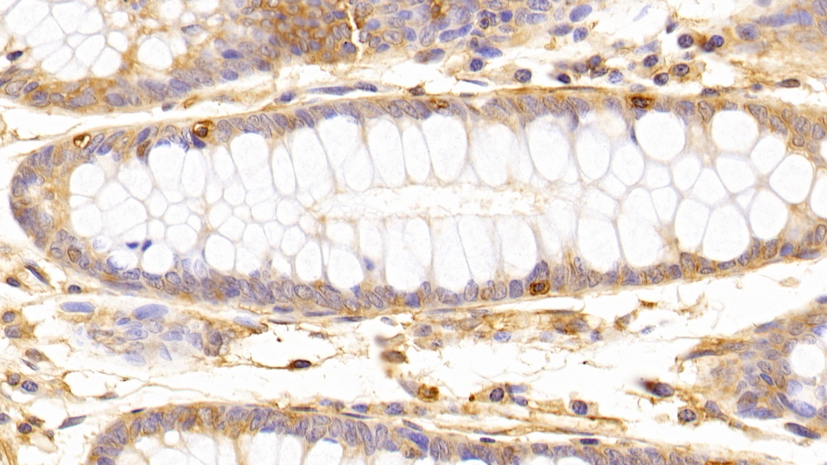 Monoclonal Antibody to Beta Actin (ACTB)