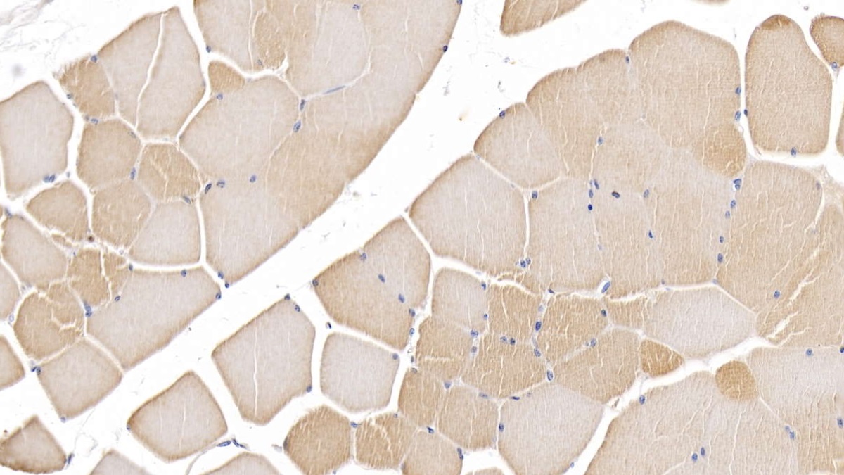 Monoclonal Antibody to Beta Actin (ACTB)