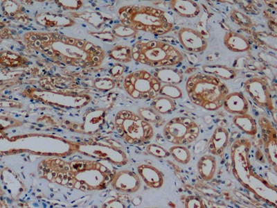 Monoclonal Antibody to Beta Actin (ACTB)