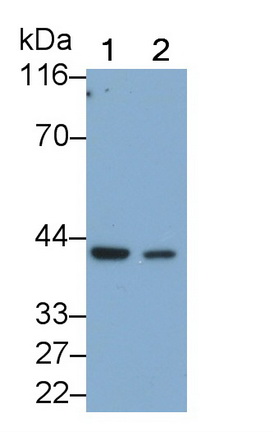 Monoclonal Antibody to Beta Actin (ACTB)